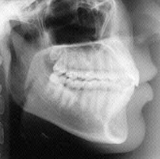 Radiologia Odontológica em Arapiraca